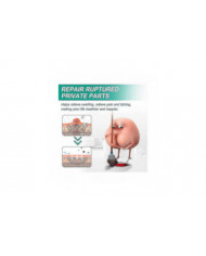 Crème d’hémorroïdes pour hommes et femmes, traitement à base de plantes, 1-3pcs