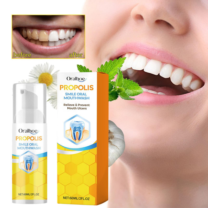 3set Propolis Oral Cleansing Mousse Oral Cleansing Care Tooth Stains Removal Fresh Mousse Toothpaste