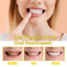 3set Propolis Oral Cleansing Mousse Oral Cleansing Care Tooth Stains Removal Fresh Mousse Toothpaste