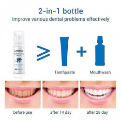 Nettoyage des dents Mousse Dentifrice Blanchiment des dents Hygiène buccale Élimine les taches de plaque Mauvaise [...]