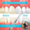 Tartar Scr Tool - Éliminateur de tartre à double extrémité pour les dents (paquet de 2)