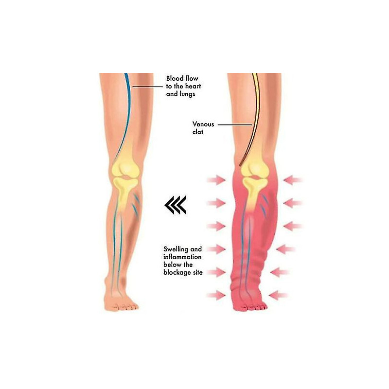 Apolloostory Drainage lymphatique Anneau magnétique thérapeutique