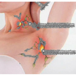 Apolloostory Drainage lymphatique Anneau magnétique thérapeutique