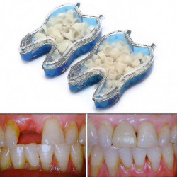 Kit dentaire temporaire pour remplacer les dents manquantes en quelques minutes Kit dentaire temporaire pour remplacer les dents manquantes en quelques minutes