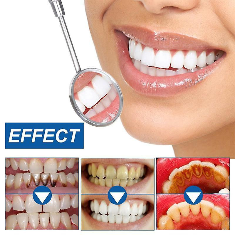 Eelhoe Tooth Whitening Powder Healthy Gums Toothpaste Brightening Products Remove Plaque Stains Oral Hygiene Teeth [...]