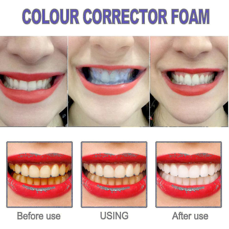 V34 Mousse Tootaste Tooth S Tartre propre Jaune S N Dents Zhexin