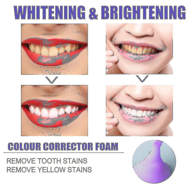 V34 Mousse Tootaste Tooth S Tartre propre Jaune S N Dents Zhexin