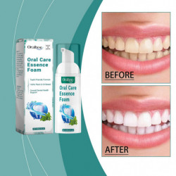 Oral Care Essence Foam, Teeth Toothpaste Cleansing Foam, Overall Dental Health Support