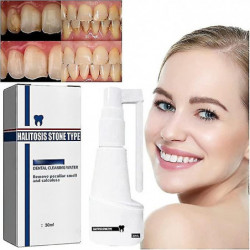 Spray dentaire dissolvant sans calcul, nettoyant dentaire pour dents décapantes, spray rafraîchissant pour la bouche