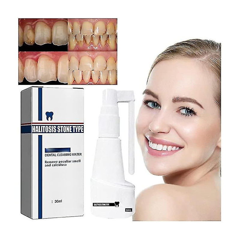 Spray dentaire dissolvant sans calcul, nettoyant dentaire pour dents décapantes, spray rafraîchissant pour la bouche