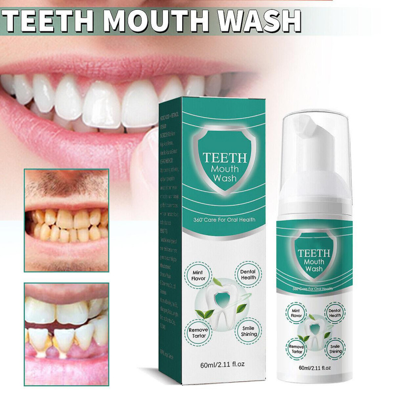 Teeth Mouth Wash Foam Toothpaste Remove Tooth Stains Fresh Oral Cleaning
