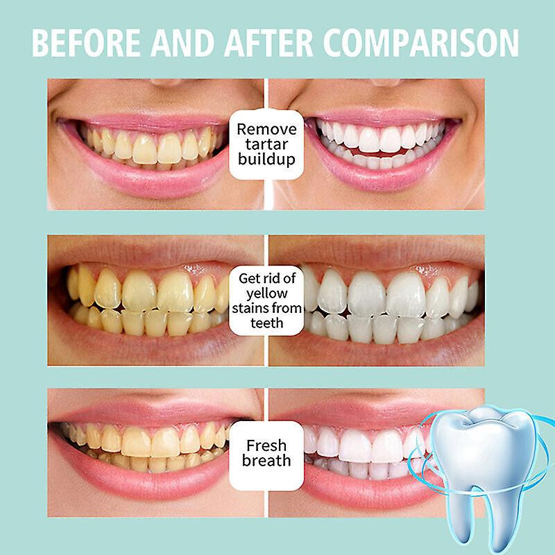 Teeth Mouth Wash Foam Toothpaste Remove Tooth Stains Fresh Oral Cleaning