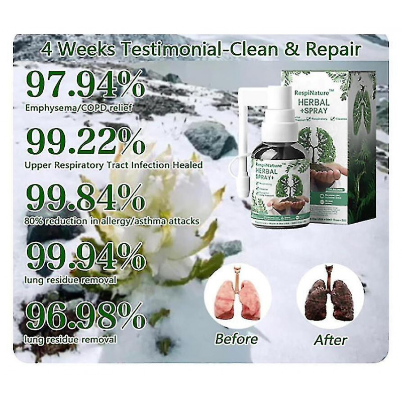 2x Herbal Lung Cleanse Mist-puissant Lung Support, 30ml Herbal Spray