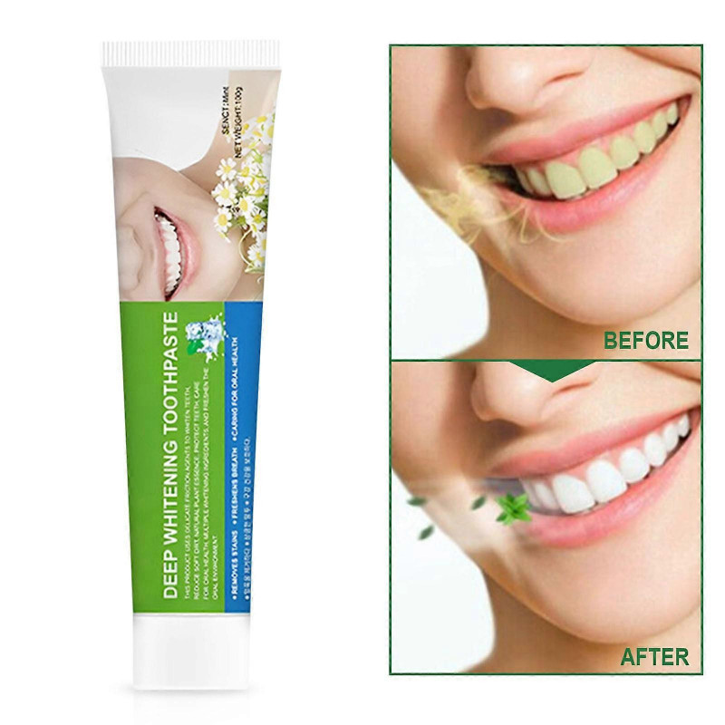 Fresh Oral Toothpaste Care Toothpaste Whitening Teeth Fresh And Long-lasting Cosmetic Sets FLY2511