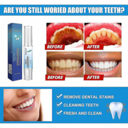 3pcs Toothbrush Pen Dental Oral Care Yellow Teeth Removal Yellow And Black Teeth Cleaning Pen Toothbrush Gel_h