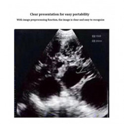 Ménage petit testeur de grossesse sans fil scanner vétérinaire mécanique échographie hine porc mouton bétail