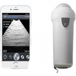 Ménage petit testeur de grossesse sans fil scanner vétérinaire mécanique échographie hine porc mouton bétail