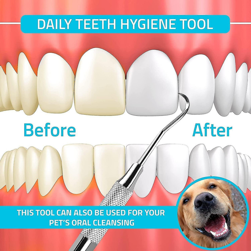 2pcs Dental Tartar Scraper Set - Dual Ended Remover - Plaque Removal