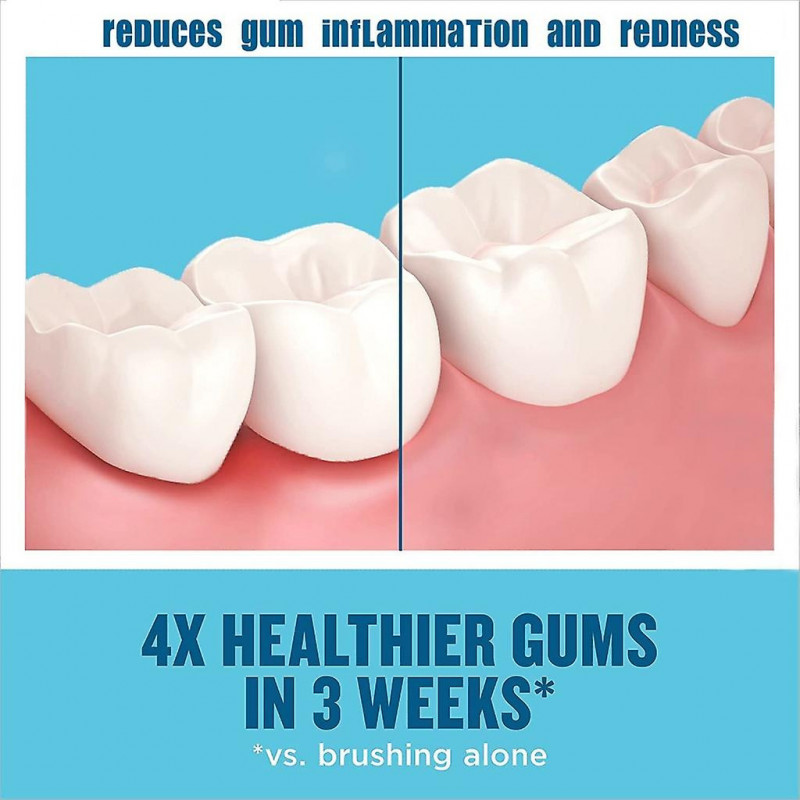 Dentifrice Mousse Blanchissante Bain De Bouche Mousse Hygiène Buccale Soins Respire Outil Dentaire