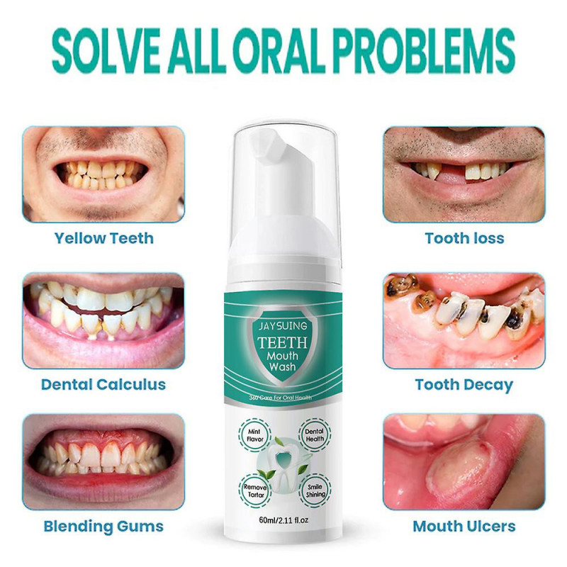 Jorondy Dents Bain de bouche Mousse Dentifrice Enlever les taches de dents Nettoyage buccal frais