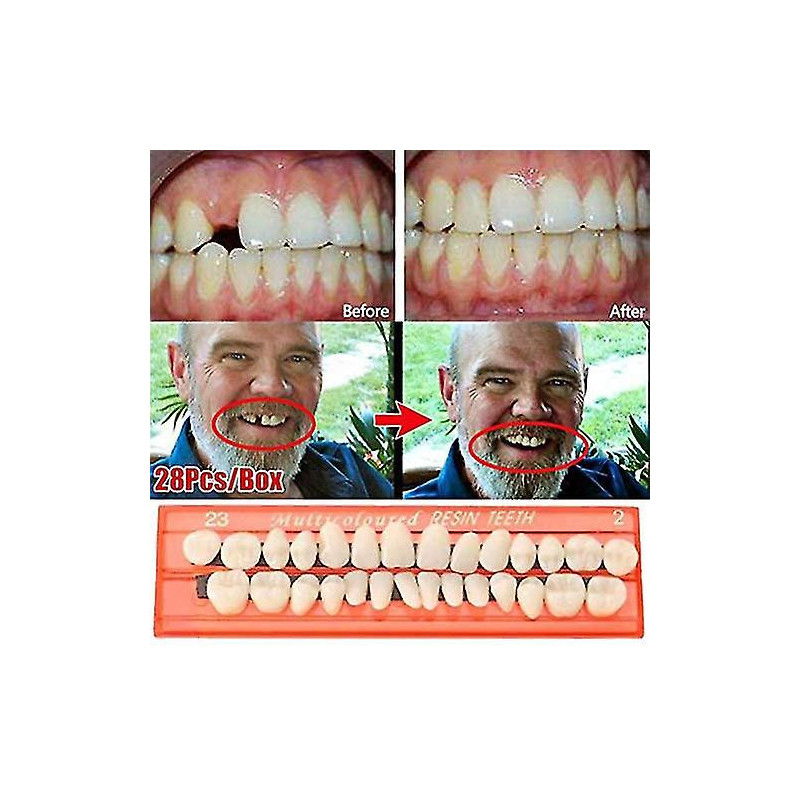 70 Pcs/bag Natural Tooth Veneers Resin Front Upper Temporary Crown Non-toxic Harmless Toothbrush For Clean And [...]