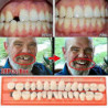 70 Pcs/bag Natural Tooth Veneers Resin Front Upper Temporary Crown Non-toxic Harmless Toothbrush For Clean And [...]