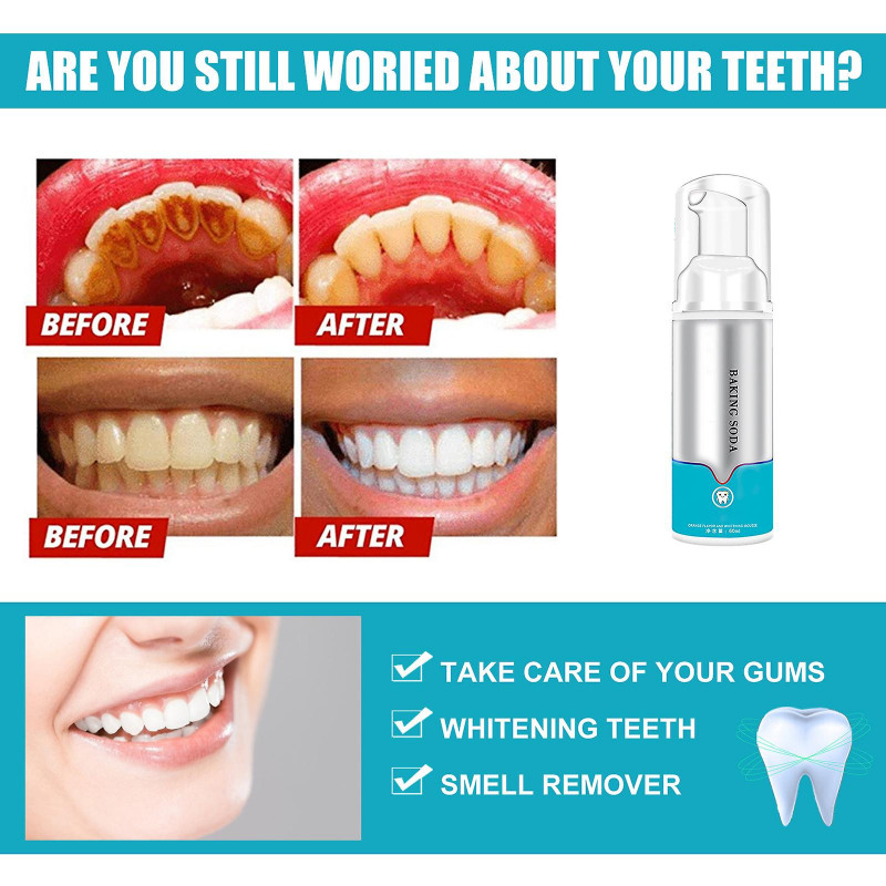 Blanchiment des dents Hygiène bucco-dentaire Blanchiment des dents Mousse de blanchiment des dents Dentifrice [...]