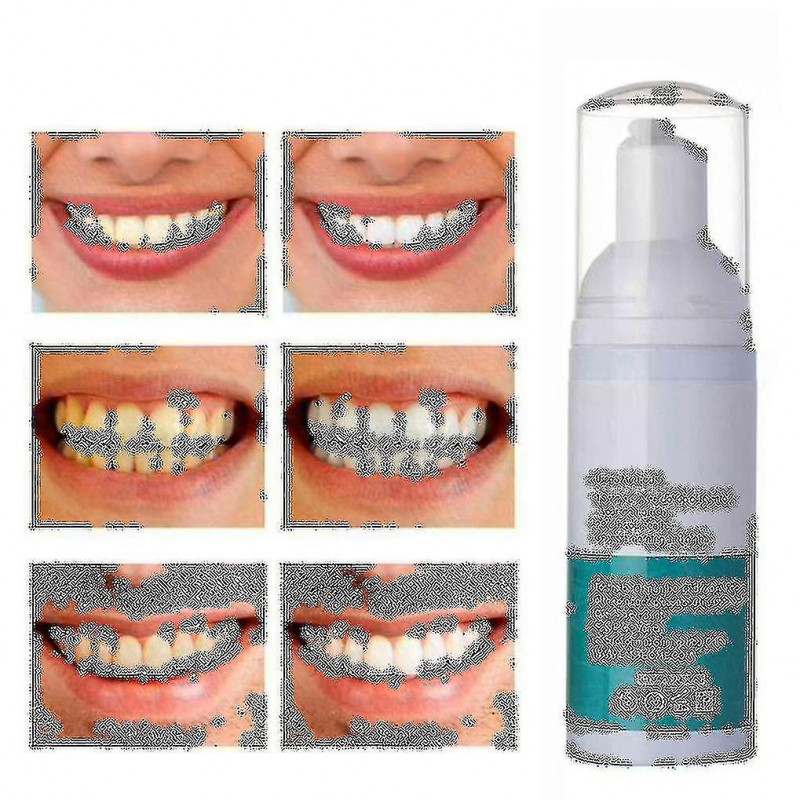 1-3pcs New Teeth Whitening Mousse Teeth Scaling Mousse Cleaning Teeth Care Fresh Oral Cleansing Care Foam