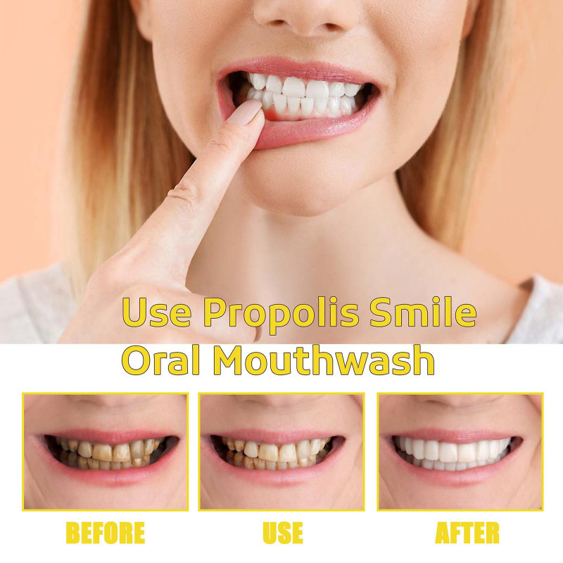 Propolis Oral Cleansing Mousse Oral Cleansing Care Tooth Stains Removal Fresh Mousse Toothpaste