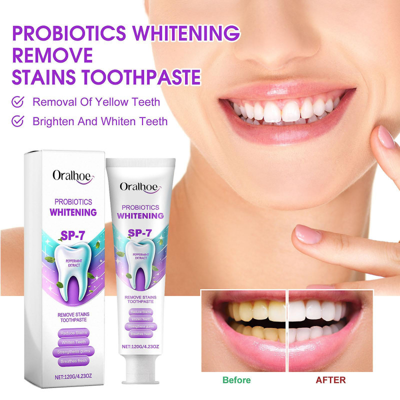 Whitening Stains Toothpaste Wash Tooth Cleaning Toothpaste Oral Care To Wipe Off Stains To Wipe Off Stains To Wipe [...]