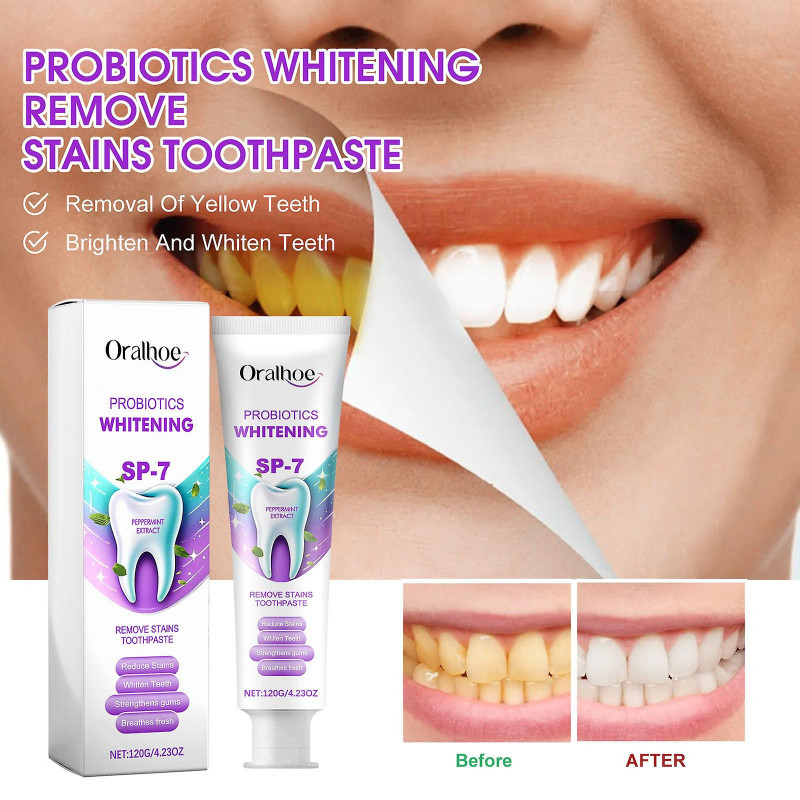 Whitening Stains Toothpaste Wash Tooth Cleaning Toothpaste Oral Care To Wipe Off Stains To Wipe Off Stains To Wipe [...]