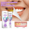 Whitening Stains Toothpaste Wash Tooth Cleaning Toothpaste Oral Care To Wipe Off Stains To Wipe Off Stains To Wipe [...]
