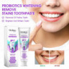 Whitening Stains Toothpaste Wash Tooth Cleaning Toothpaste Oral Care To Wipe Off Stains To Wipe Off Stains To Wipe [...]