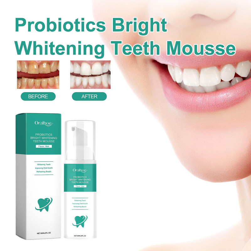 Teeth Mouth Wash Tooth Cleaning Toothpaste Oral Care To Wipe Off Stains To Wipe Off Stains To Wipe Off Yellow [...]