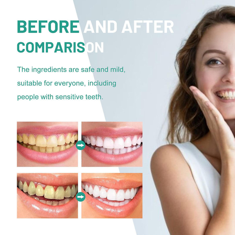 Teeth Mouth Wash Tooth Cleaning Toothpaste Oral Care To Wipe Off Stains To Wipe Off Stains To Wipe Off Yellow [...]