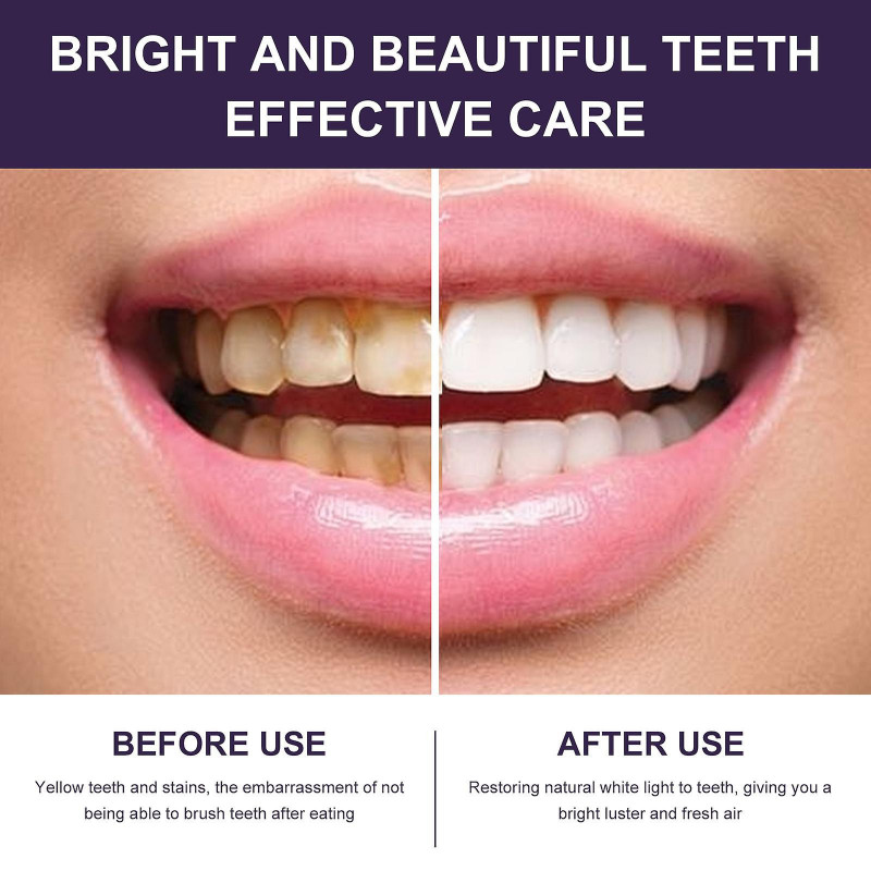 Purple Beautiful Tooth Mouthwash Teeth Cleaning Yellow Teeth Stain Whitening Fresh Breath Oral Care