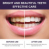Purple Beautiful Tooth Mouthwash Teeth Cleaning Yellow Teeth Stain Whitening Fresh Breath Oral Care