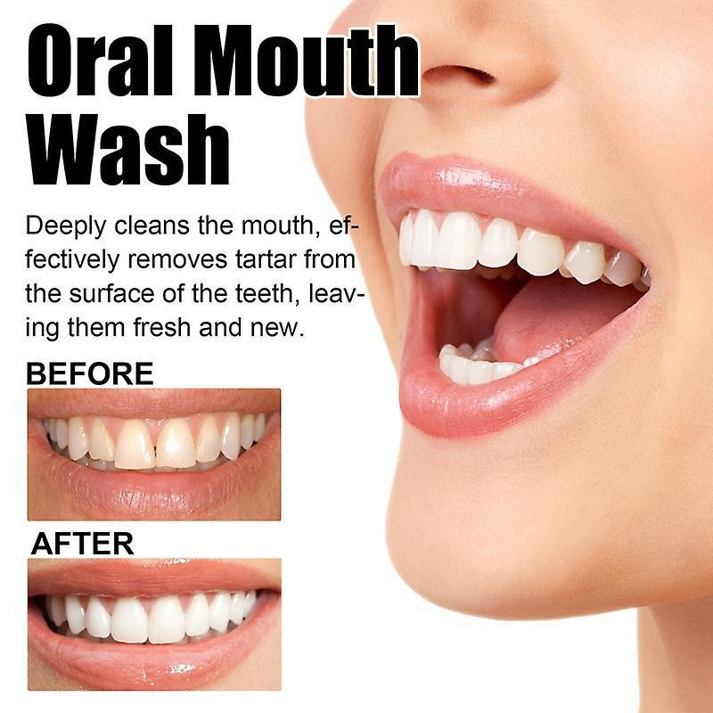 Oral Cleansing Mousse Teeth Cleaning Repair Teeth Yellow Teeth Stains Dazzling White Beautiful Tooth Fresh Breath