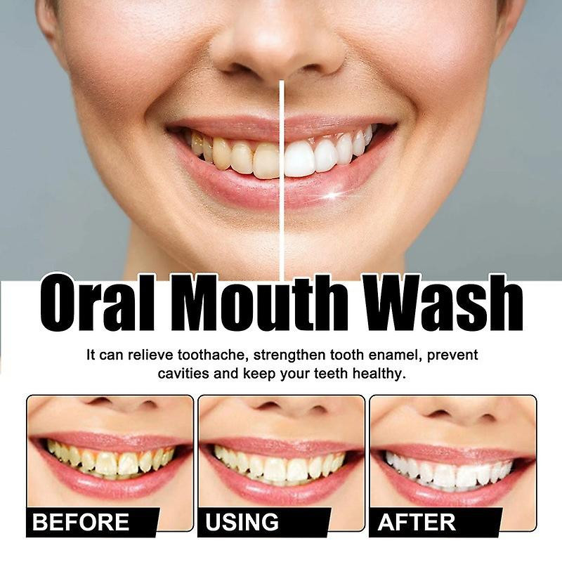 Oral Cleansing Mousse Teeth Cleaning Repair Teeth Yellow Teeth Stains Dazzling White Beautiful Tooth Fresh Breath