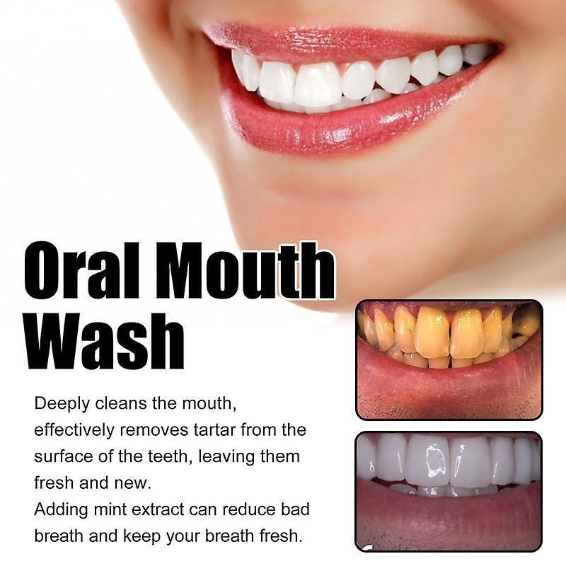 Oral Cleansing Mousse Teeth Cleaning Repair Teeth Yellow Teeth Stains Dazzling White Beautiful Tooth Fresh Breath