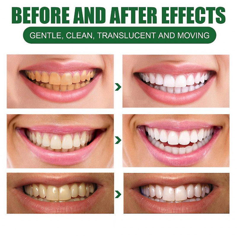 Mint Toothpaste Remove Plaque Stains Oral Odor for Fresh- Oral Care Tool