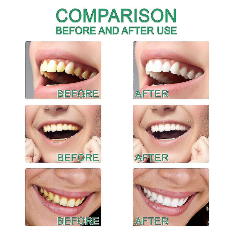 Born Pretty 7 Days Teeth Whitening Powder Clean Teeth Soins bucco-dentaires Breath Clean Tooth Stains Removal [...]