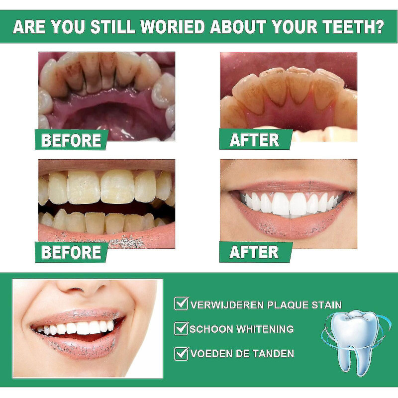 Born Pretty 7 Days Teeth Whitening Powder Clean Teeth Soins bucco-dentaires Breath Clean Tooth Stains Removal [...]