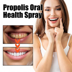 2x Oral Fresh Spray Désodorisant Buccal Traitement Oral Odeur Traitement Oral Enlever Mauvaise Haleine Saveur [...]