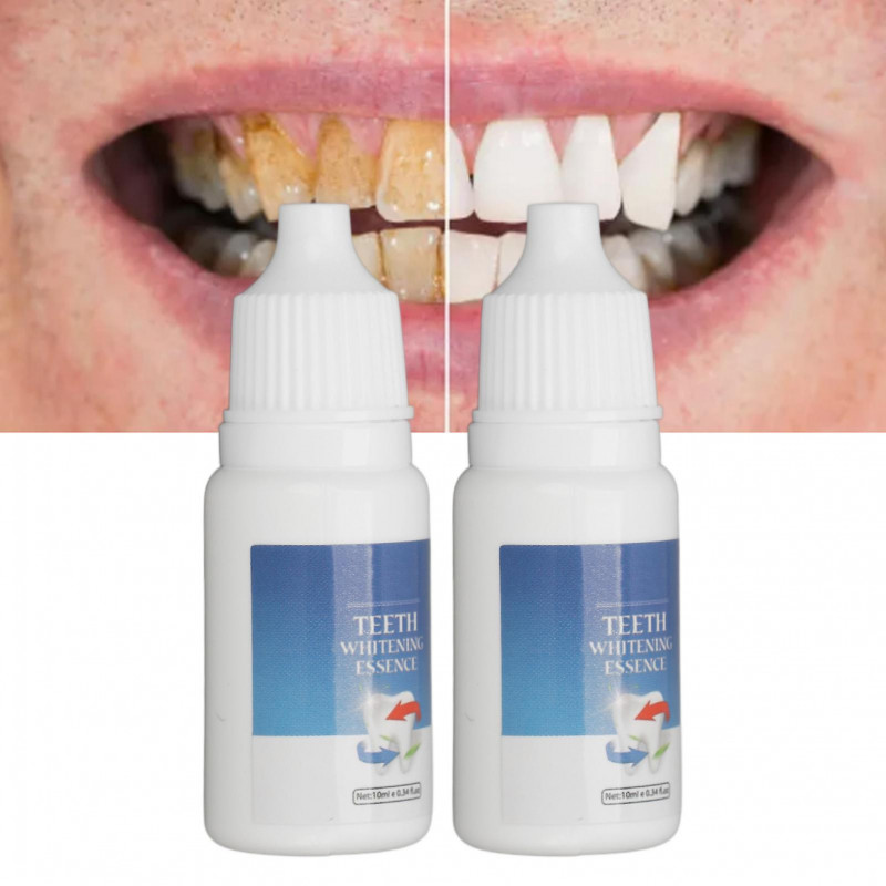 2 sets 2pcs 10ml Whitening Teeth Oral Serum Removes Plaque Stains Hypoallergenic Temporary Teeth Whitening Liquid