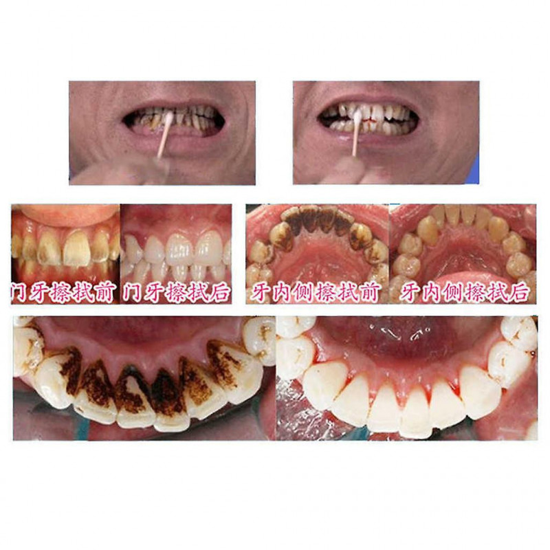 3x 10ml Blanchiment Oral Nettoyage Liquide Détachant Soin Bucco-Dentaire