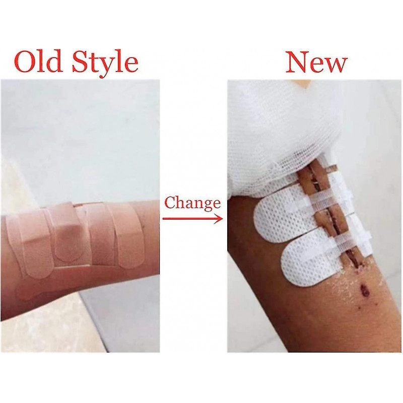 Fermetures de plaies d’urgence Bandages adhésifs pansements, autocollants de point de fermeture éclair pour le [...]