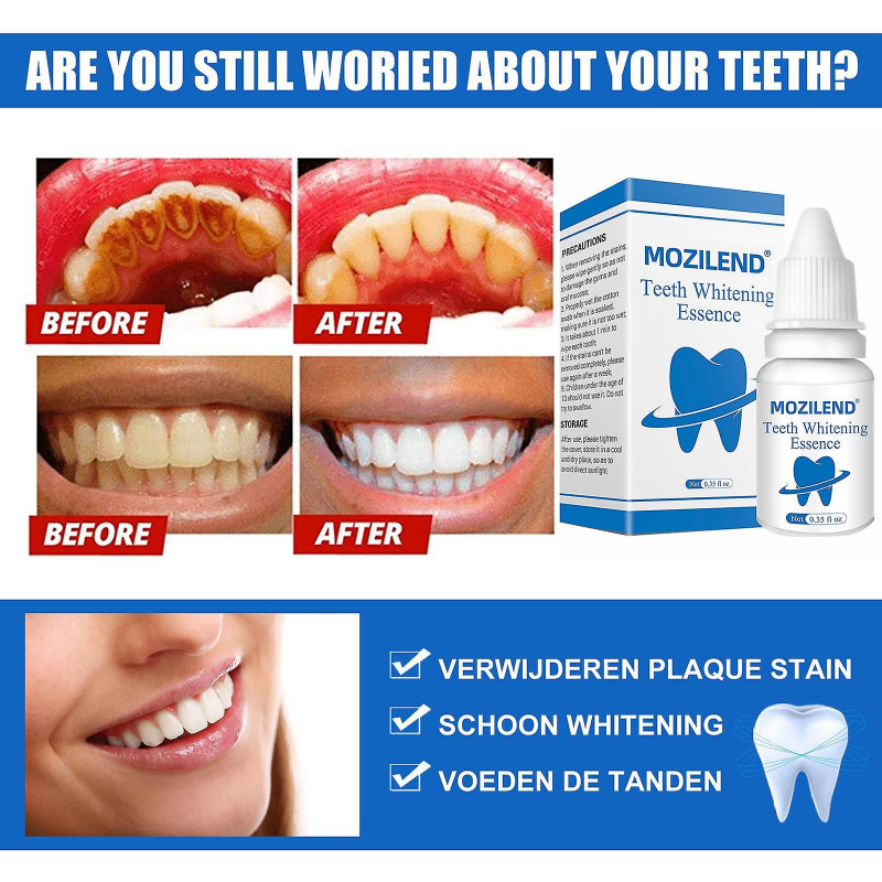 Mardi Gras Gifts Teeth Whitening Serum Gel Oral Hygiene Effective Stains Plaque Teeth Cleaning Essence Care [...]