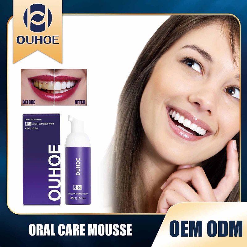 Whitening Oral Care spray Whitening Teeth Yellow Teeth Cleaning Stain Correction Oral spray Mardi Gras Gifts