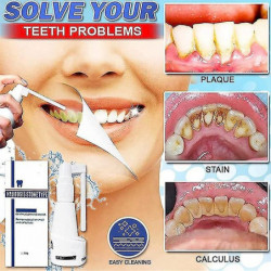 30ml Spray dentaire dissolvant sans calcul, nettoyant dentaire pour dents décapantes, spray rafraîchissant pour la [...]